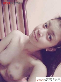 หลุดจากกล้องหลังเอาโทรศัพท์ไปซ่อม